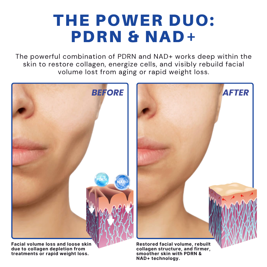 ATTDX® PDRN-NAD+ Cica Reedle Shot Serum