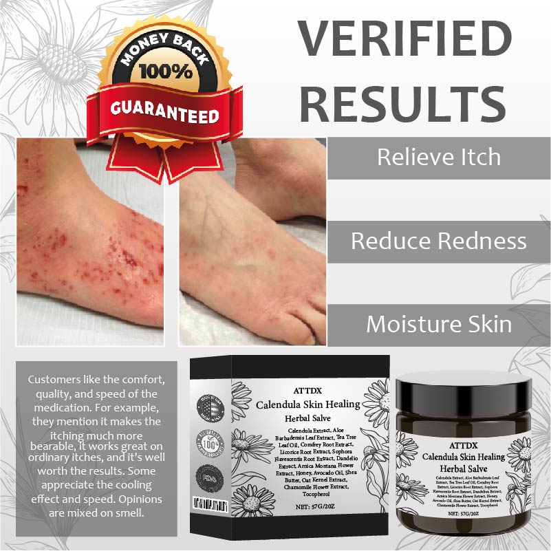 Calendula SkinHealing Herbal Salve