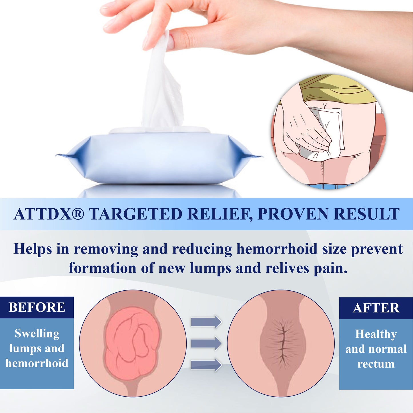ATTDX® Advanced Relief Hemorrhoid Flushable Wipes