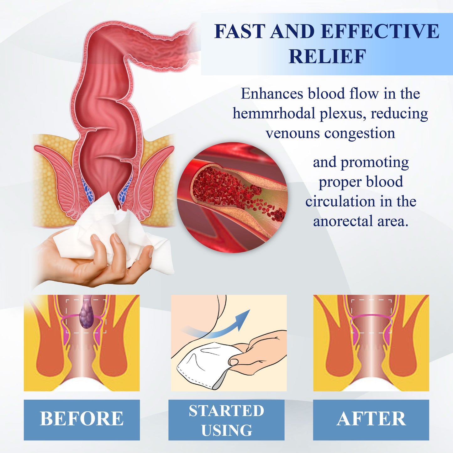 ATTDX® Advanced Relief Hemorrhoid Flushable Wipes