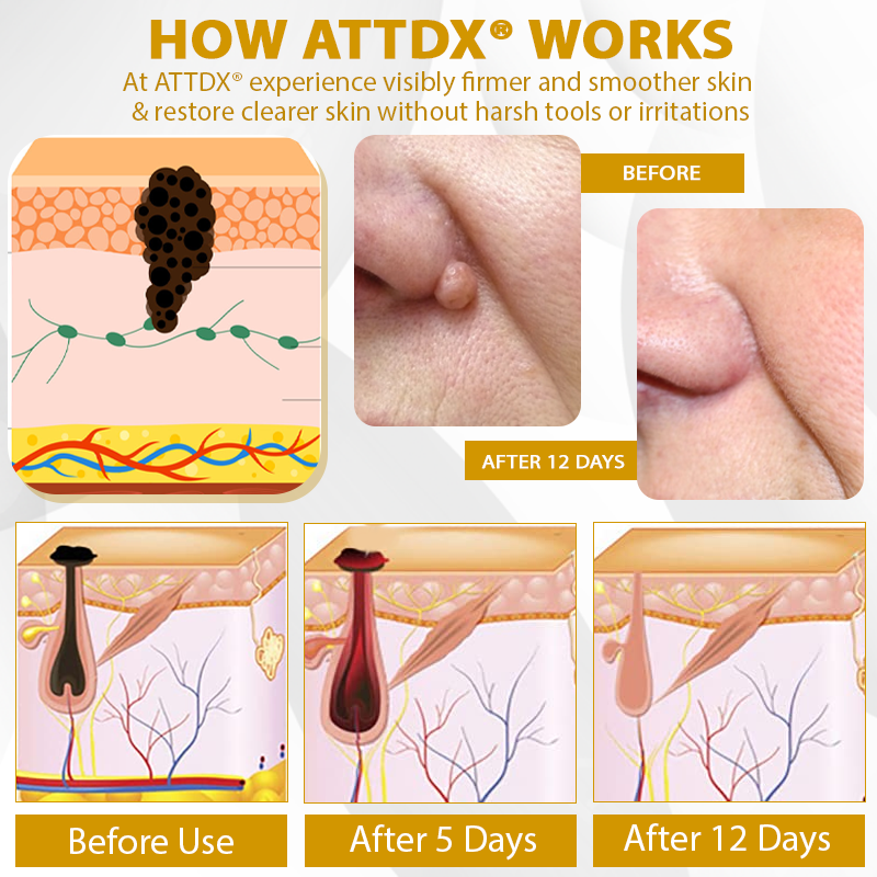 ATTDX® CastorBee Tag & Spots Peel-Off Mask