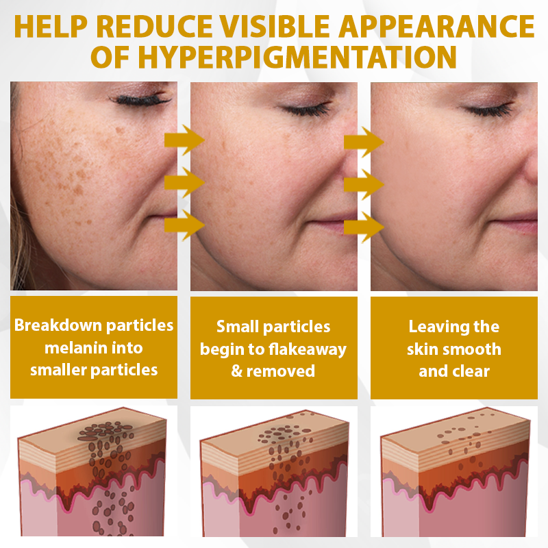 ATTDX® CastorBee Tag & Spots Peel-Off Mask
