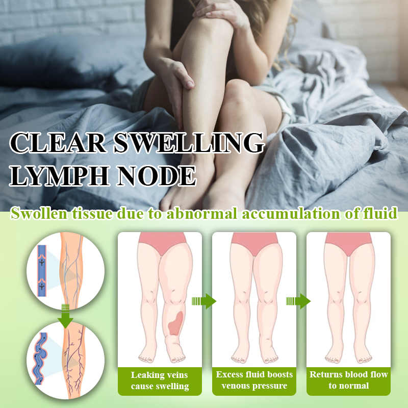ATTDX® Fluid Regulation Edema Care Cream