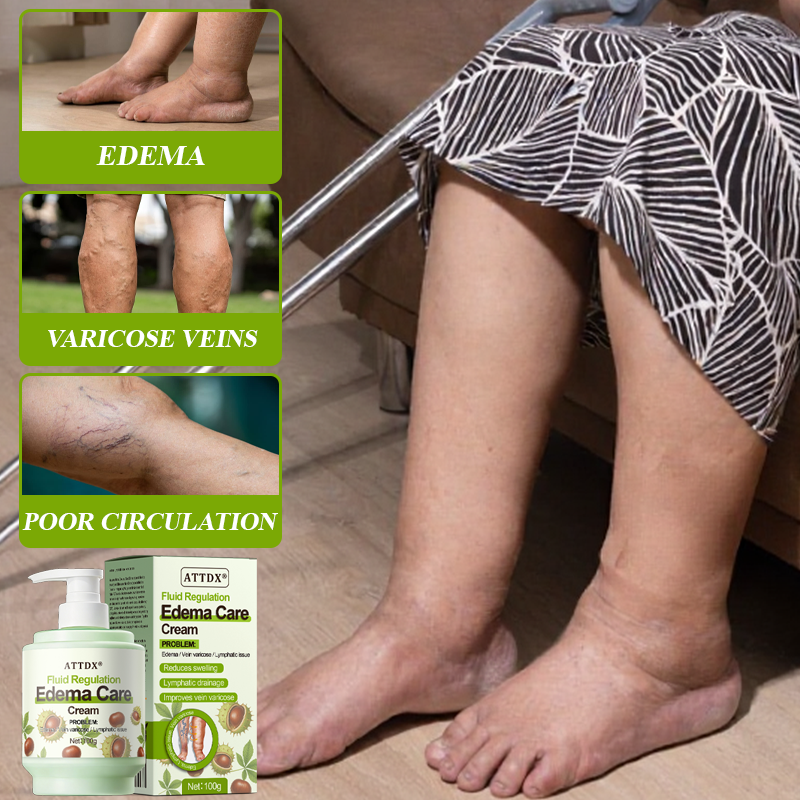 ATTDX® Fluid Regulation Edema Care Cream