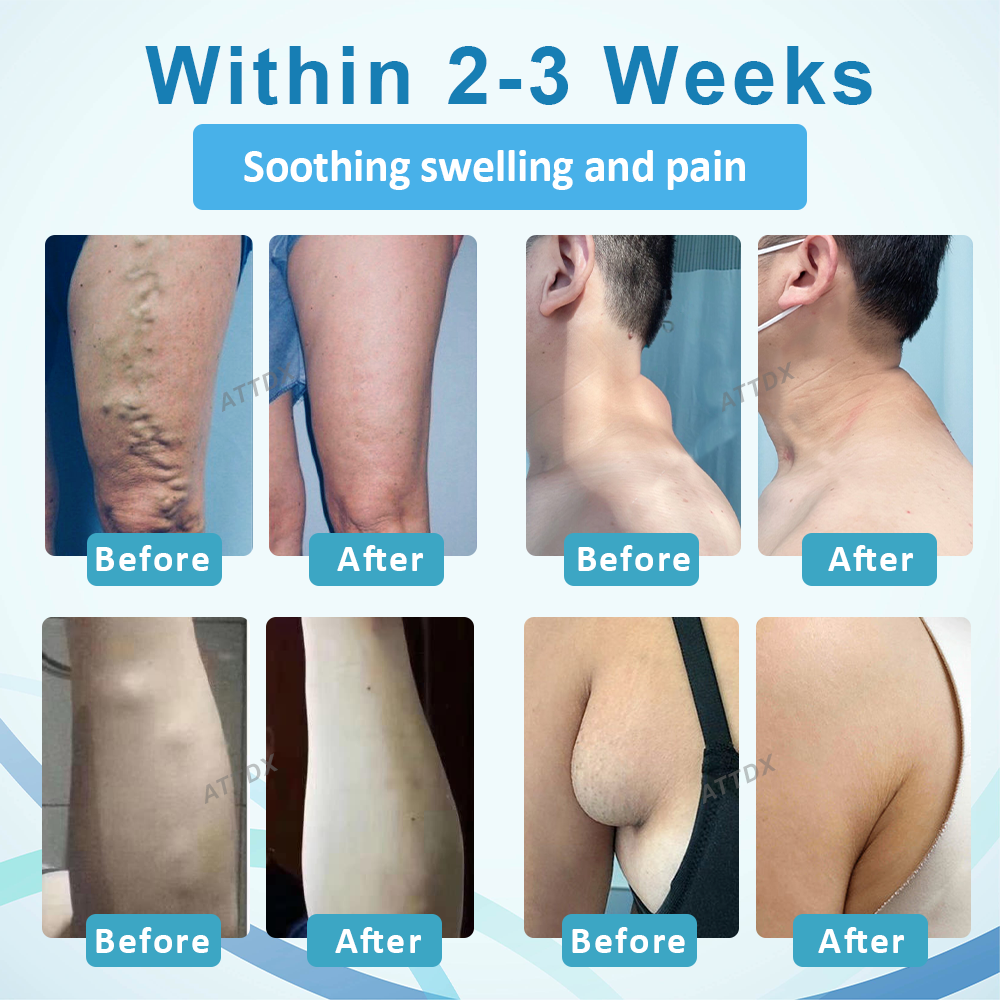 ATTDX™ LumpsClear Lymph Support Roll-On