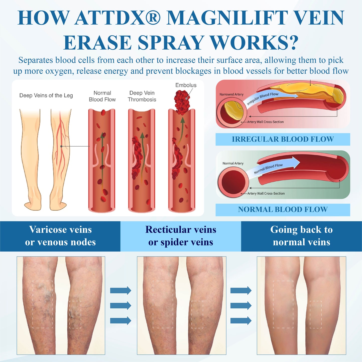ATTDX® MagniLift VeinErase Spray