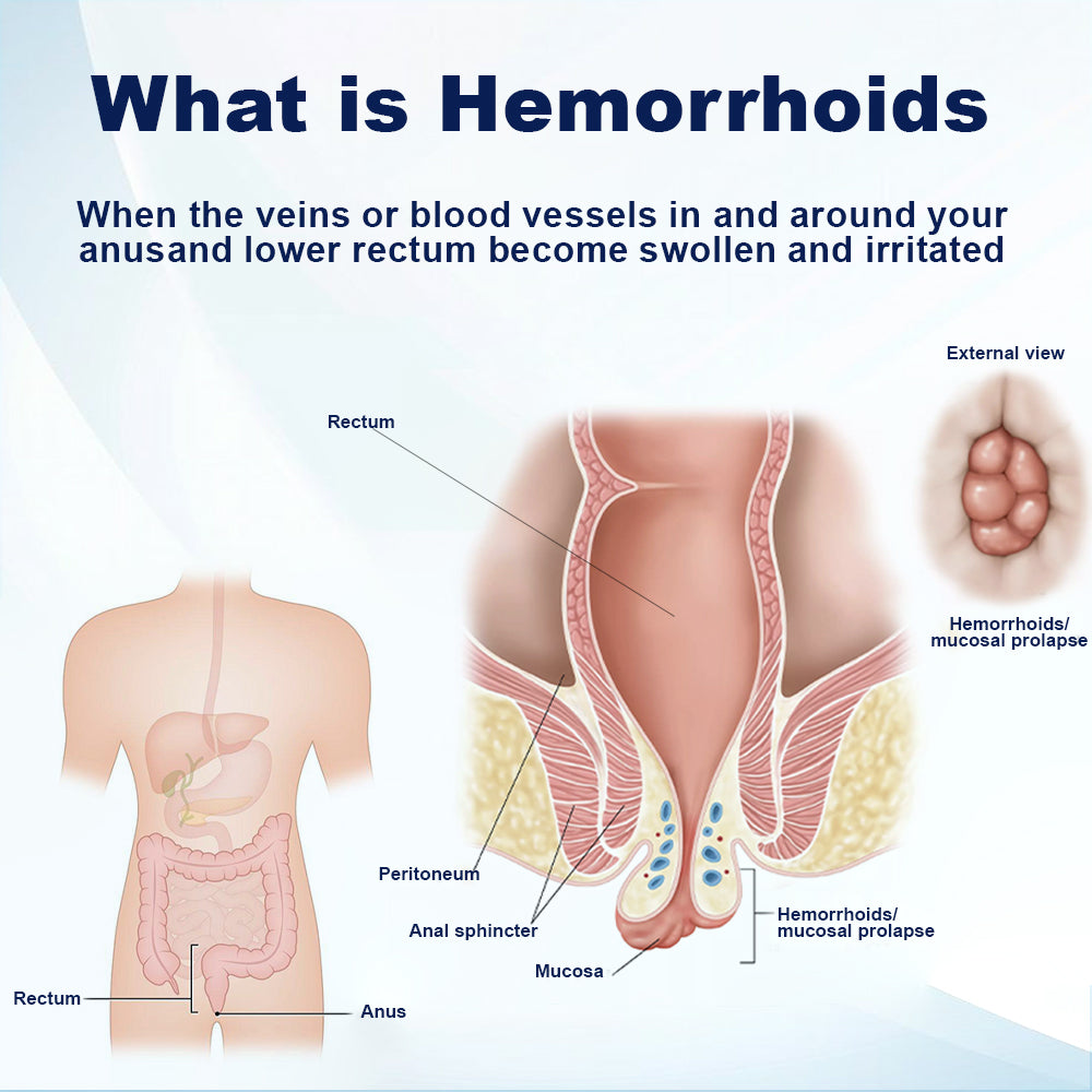 ATTDX™ Natural Herb HemorrhoidCare Capsules