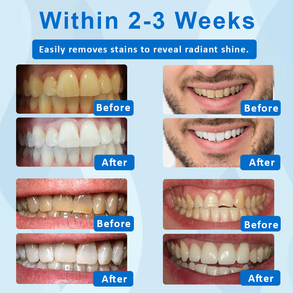 ATTDX™ NanoWhite Tooth Stain Cleaner