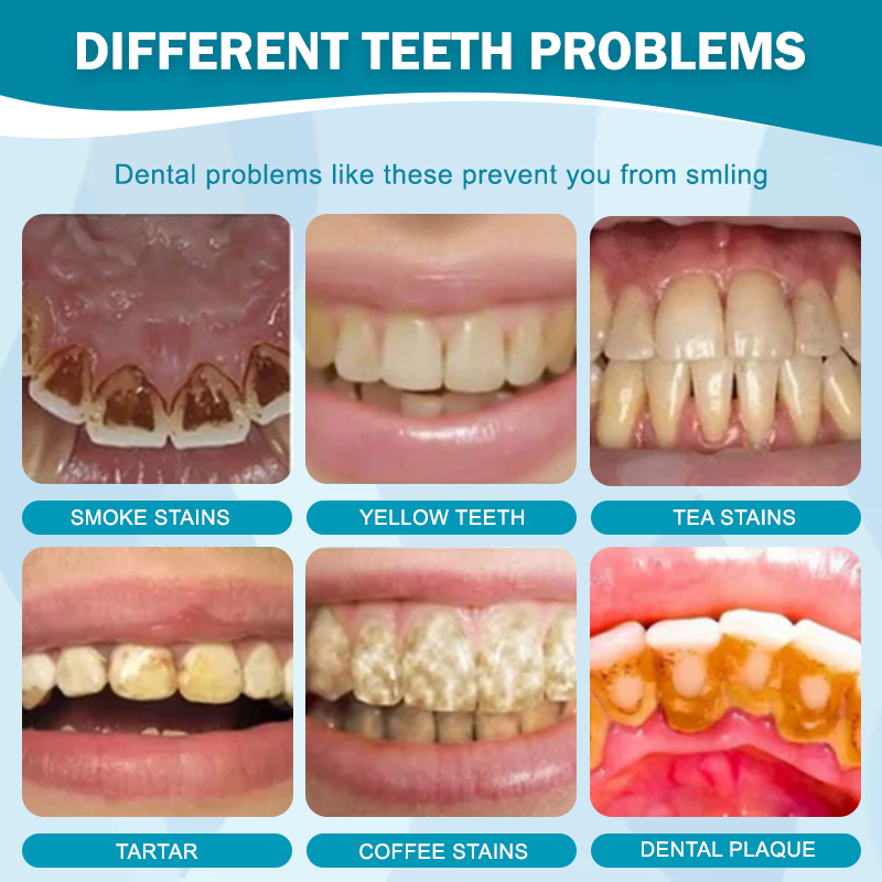 ATTDX™PureSmile Teeth Whitening Pen