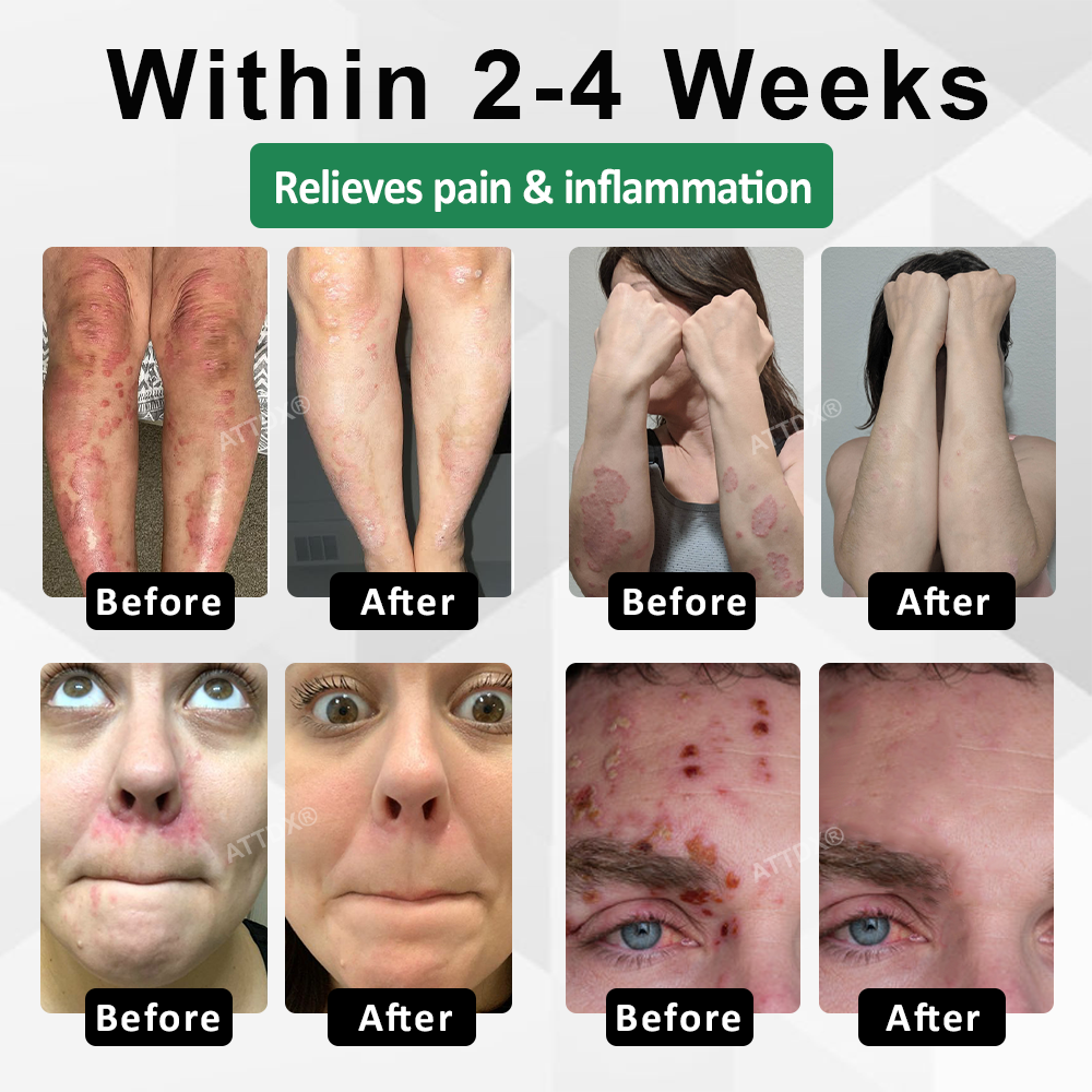 ATTDX® Snake Peptide Shingles Skincare Ampoules