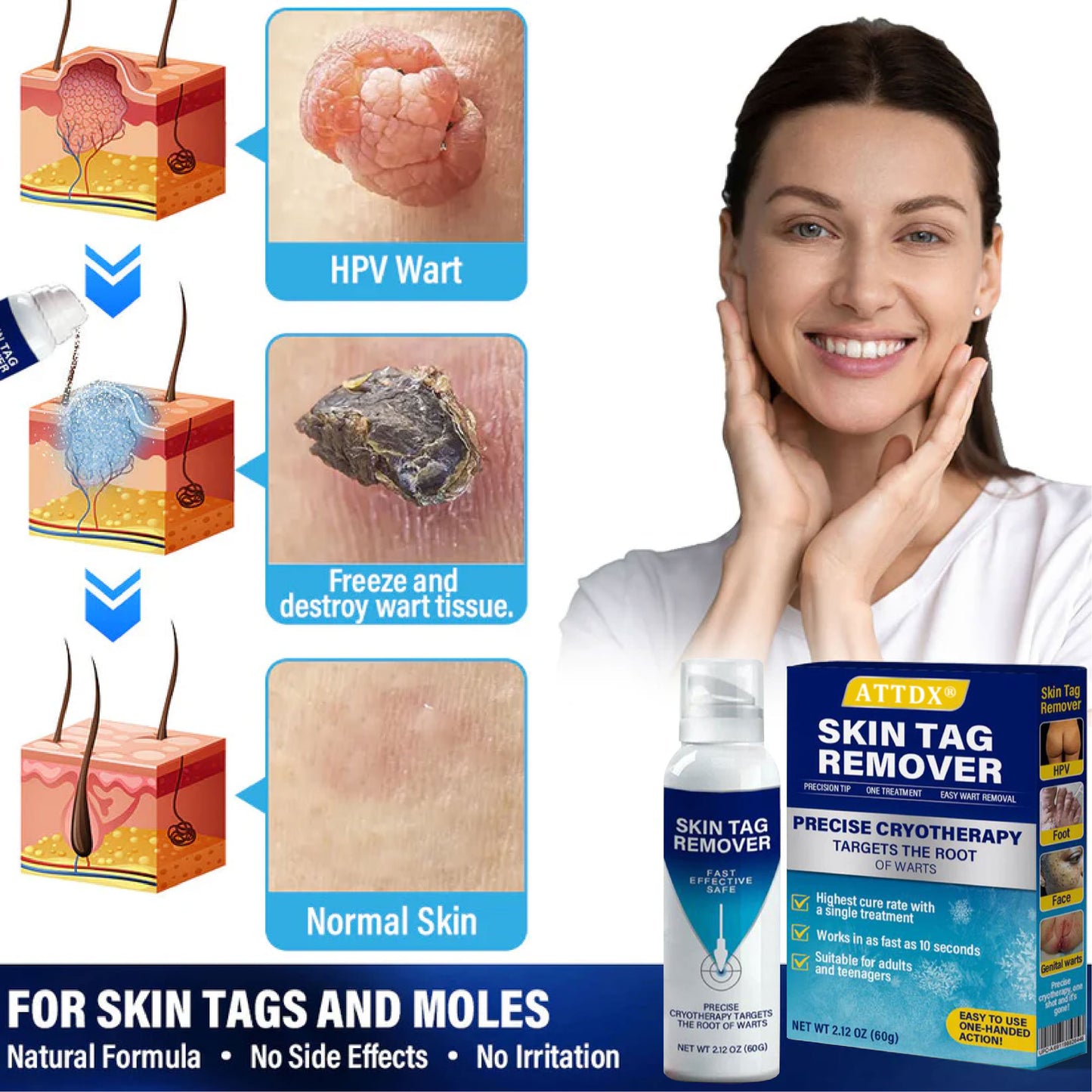 ATTDX® TagRecede Cryo Treatment Spray