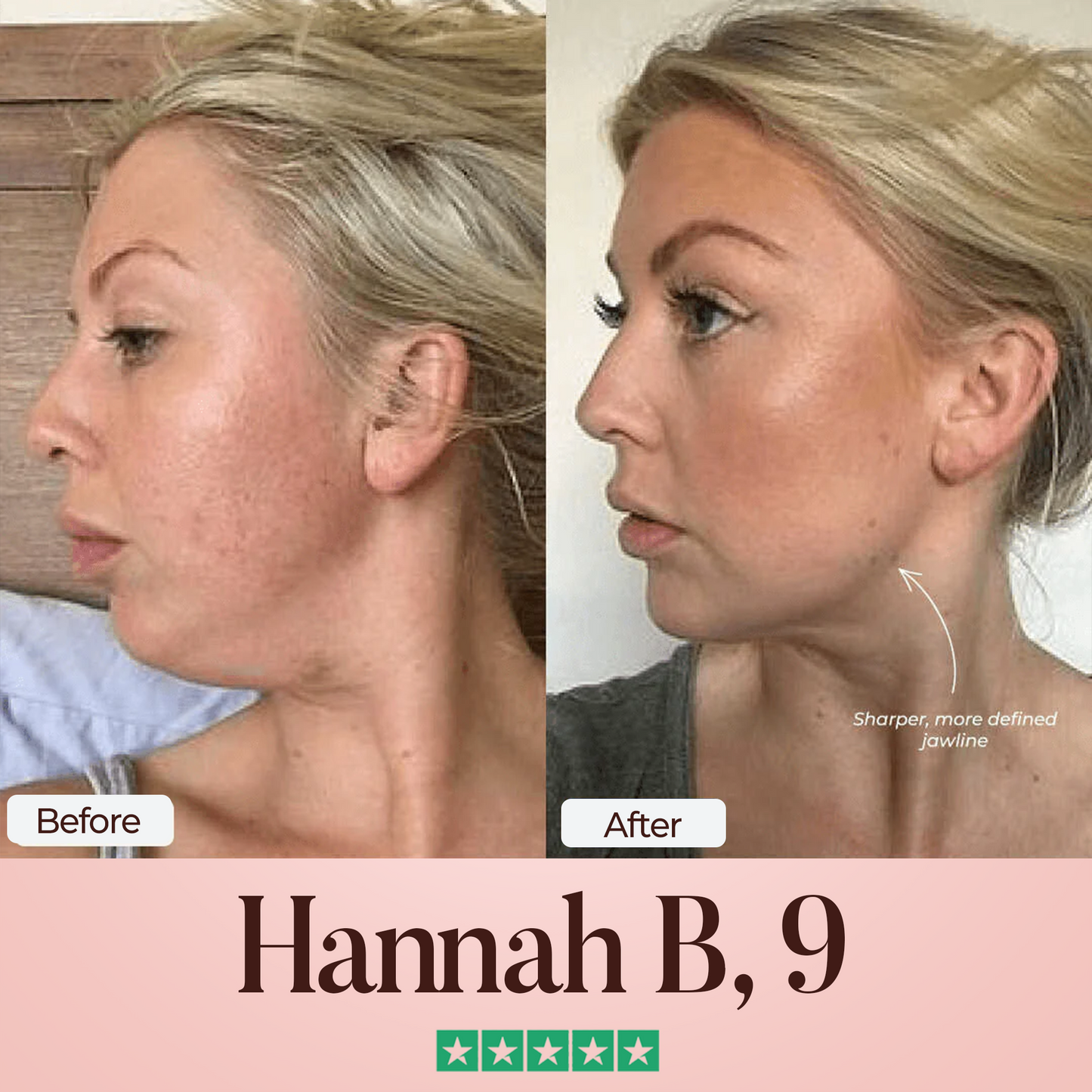ATTDX® SculptFix Mask Infused with Retinol & Collagen 👩 Reveal Your Best Jawline