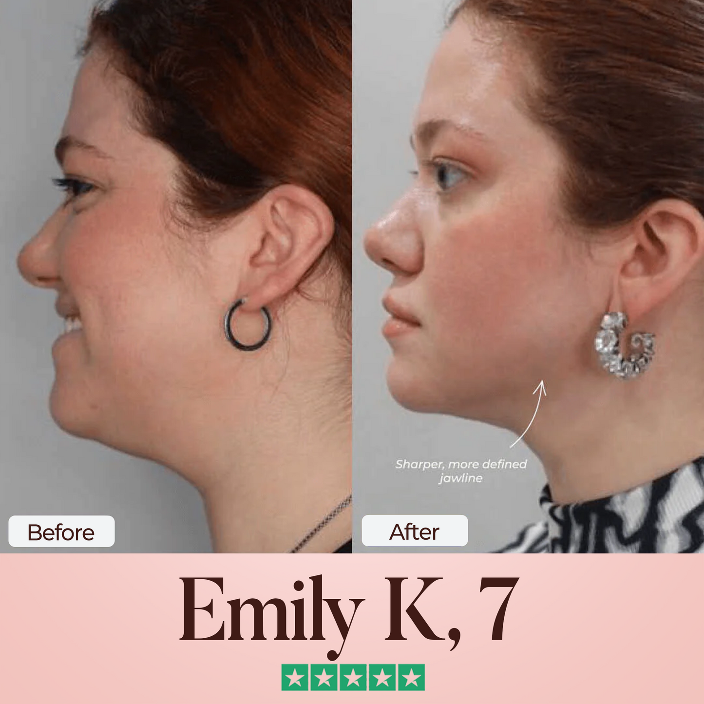 ATTDX® SculptFix Mask Infused with Retinol & Collagen 👩 Reveal Your Best Jawline