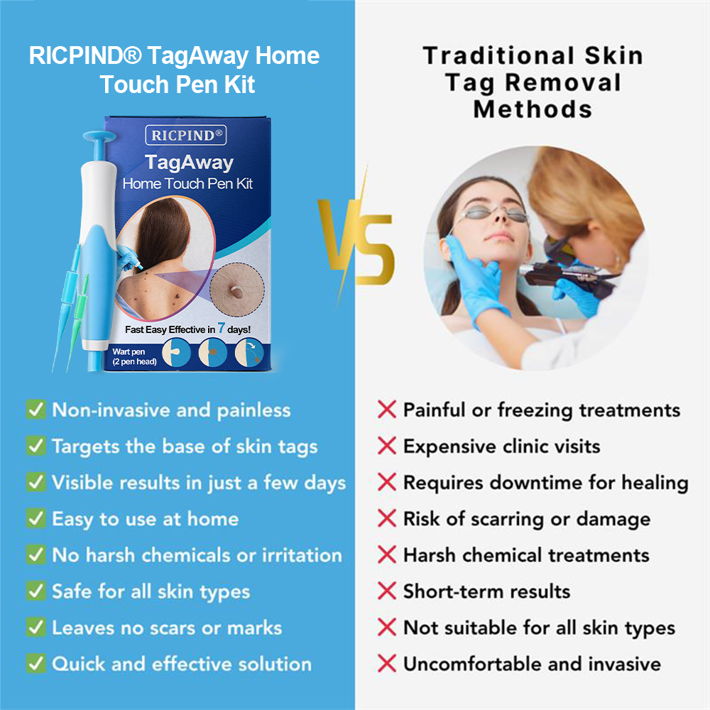 RICPIND® TagAway Home Touch Pen Kit