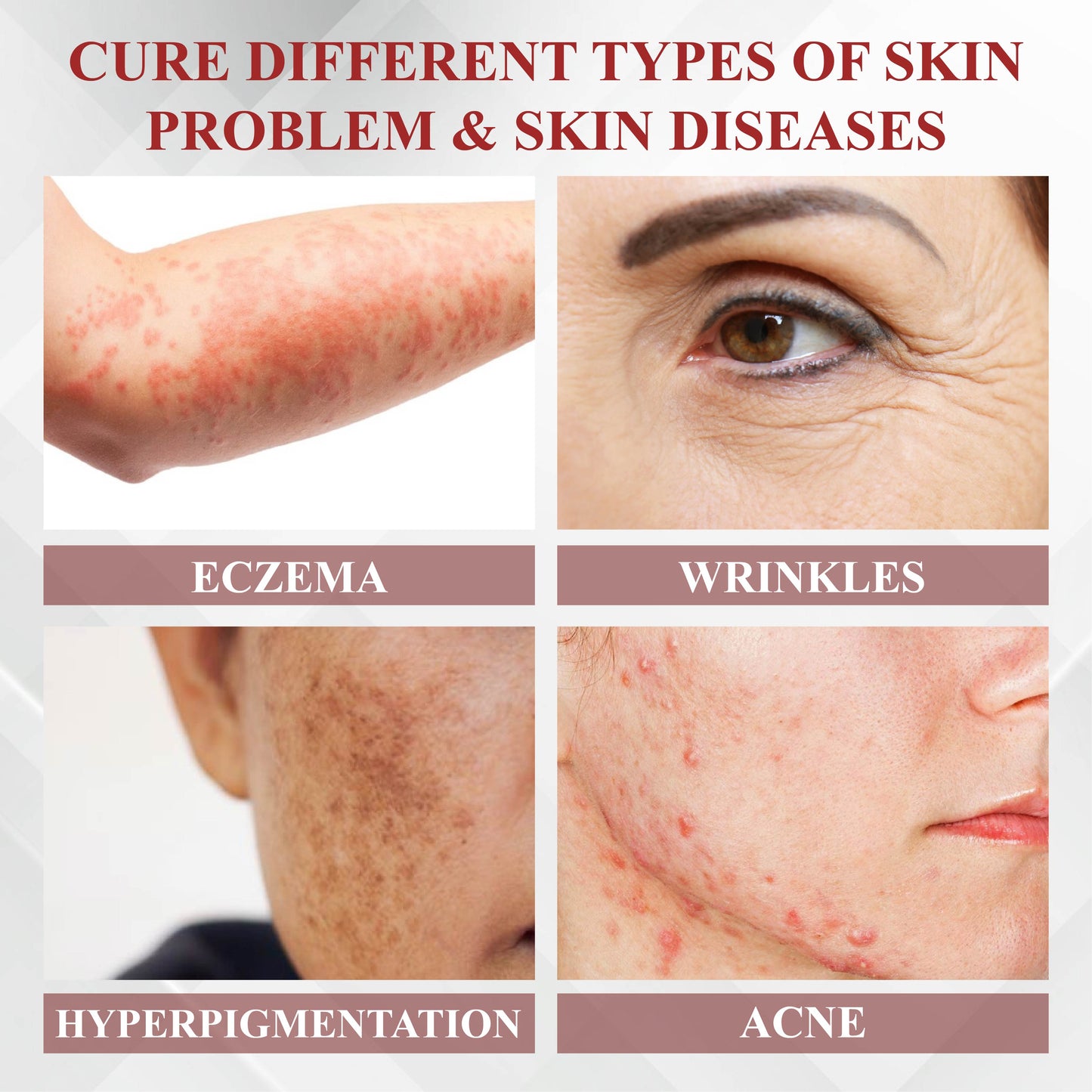 RelievaDerm™ Emu Oil Skin Therapy Botanical Ointment