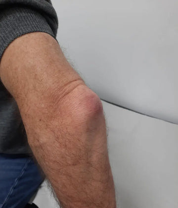 ATTDX® ApiMotion Herbal Joint Comfort Balm 32 ATTDX® ApiMotion Herbal Joint Comfort Balm