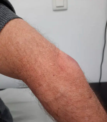 ATTDX® ApiMotion Herbal Joint Comfort Balm 33 ATTDX® ApiMotion Herbal Joint Comfort Balm