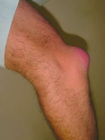 ATTDX® ApiMotion Herbal Joint Comfort Balm 31 ATTDX® ApiMotion Herbal Joint Comfort Balm