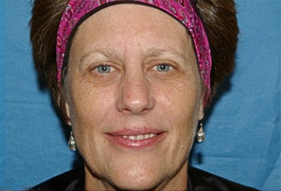 ATTDX® PDRN-NAD+ Cica Reedle Shot Serum 31 ATTDX® PDRN-NAD+ Cica Reedle Shot Serum