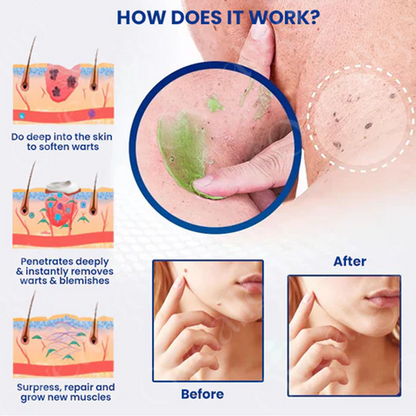 ATTDX® NatureErase Instant Alligator Oil Mole & Spot Cream