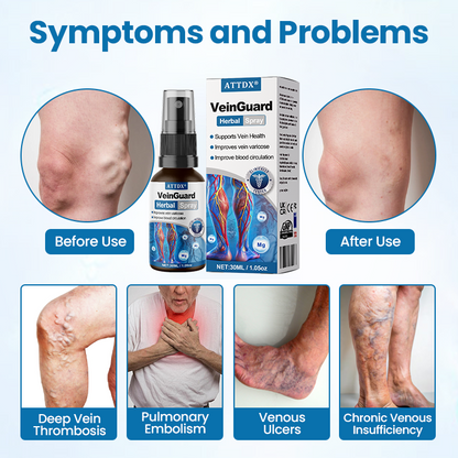 ATTDX® VeinGuard Herbal Spray
