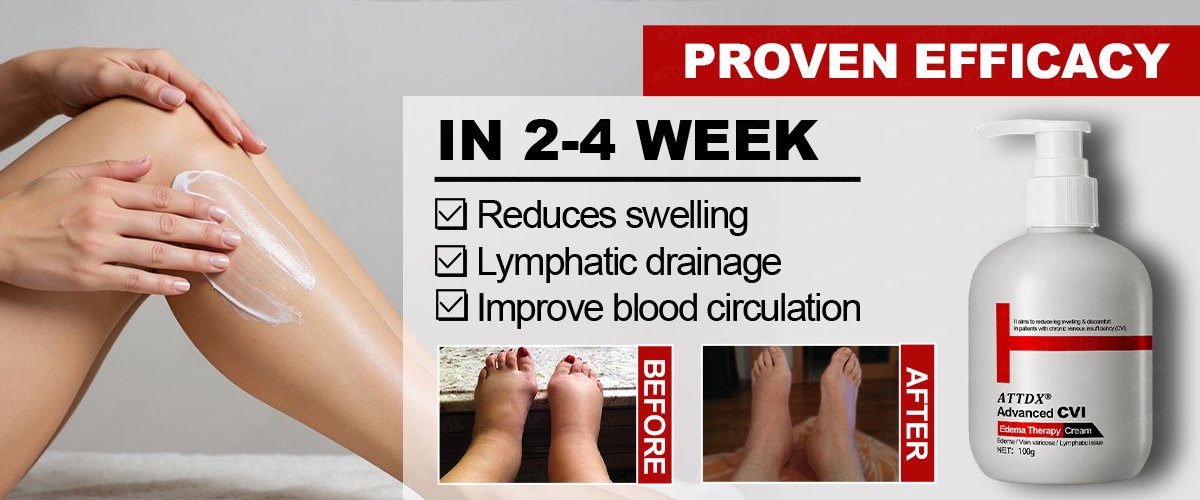 ATTDX® Advanced CVI Edema Therapy Cream 26 ATTDX Advanced CVI Edema Therapy Cream11 91c2a734 daa8 4361 9207 e94e0bf37bcd