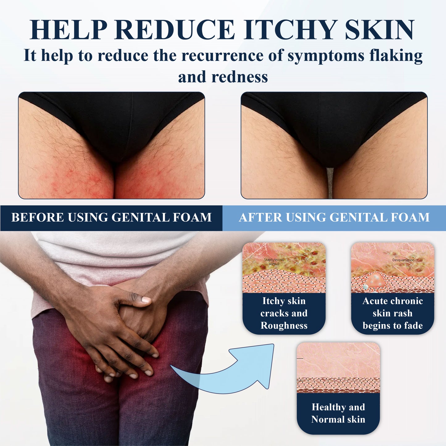 ATTDX® Advanced HPV & Rash Relief Genital Foam