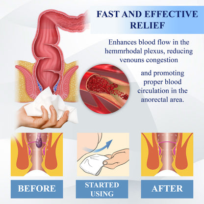 ATTDX® Advanced Relief Hemorrhoid Flushable Wipes