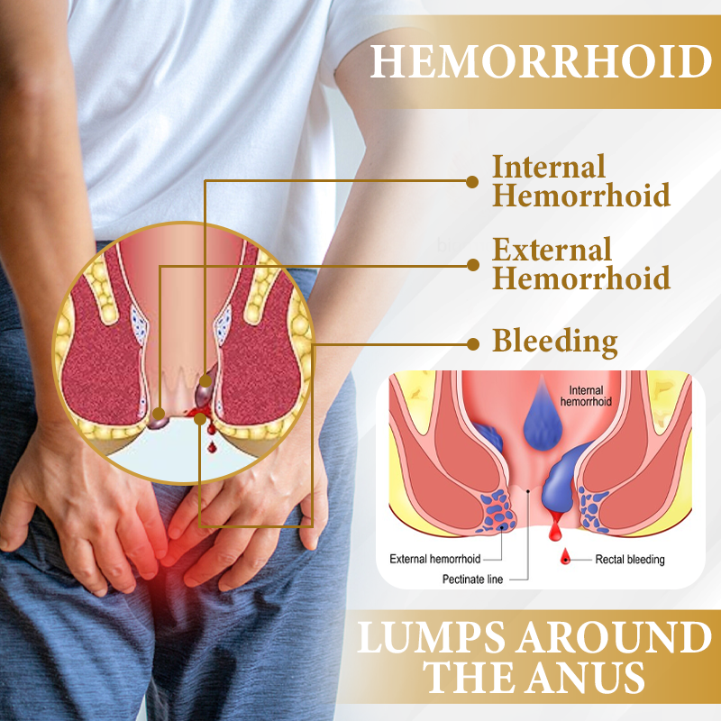ATTDX® Apis Venom Hemorrhoid Cooling Spray