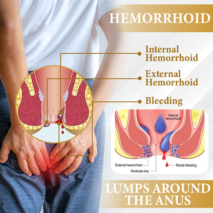 ATTDX® Apis Venom Hemorrhoid Cooling Spray