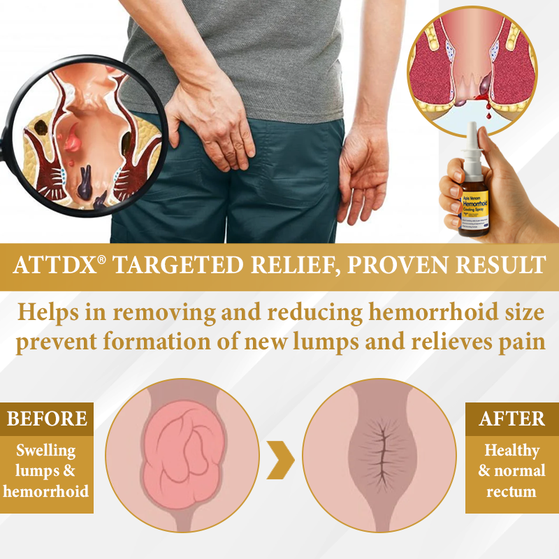 ATTDX® Apis Venom Hemorrhoid Cooling Spray 21 ATTDX® Apis Venom Hemorrhoid Cooling Spray