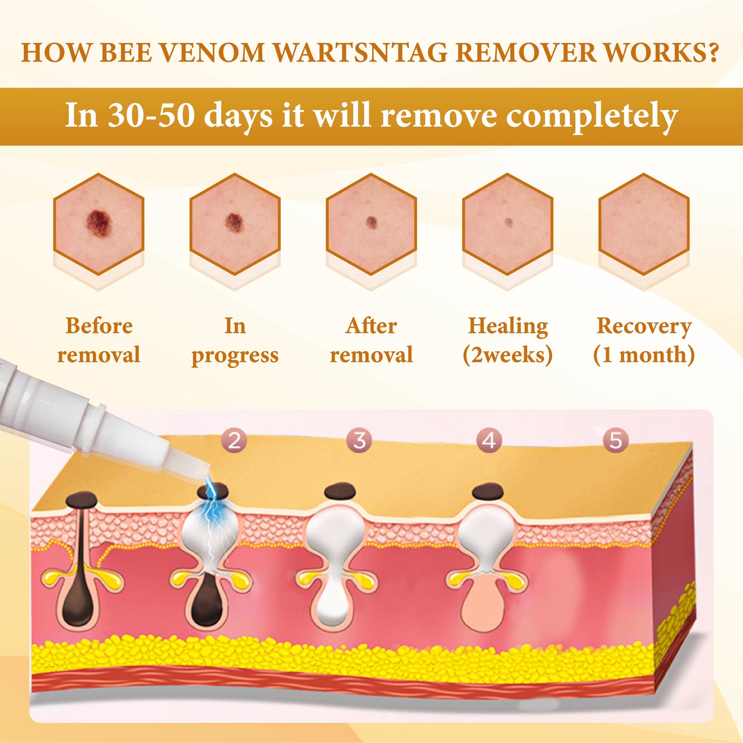 Bee Venom WartsNTag SmoothClear Remover