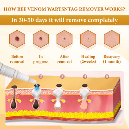 Bee Venom WartsNTag SmoothClear Remover