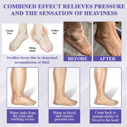 ATTDX® Bilberry EaseFluid Edema Gel