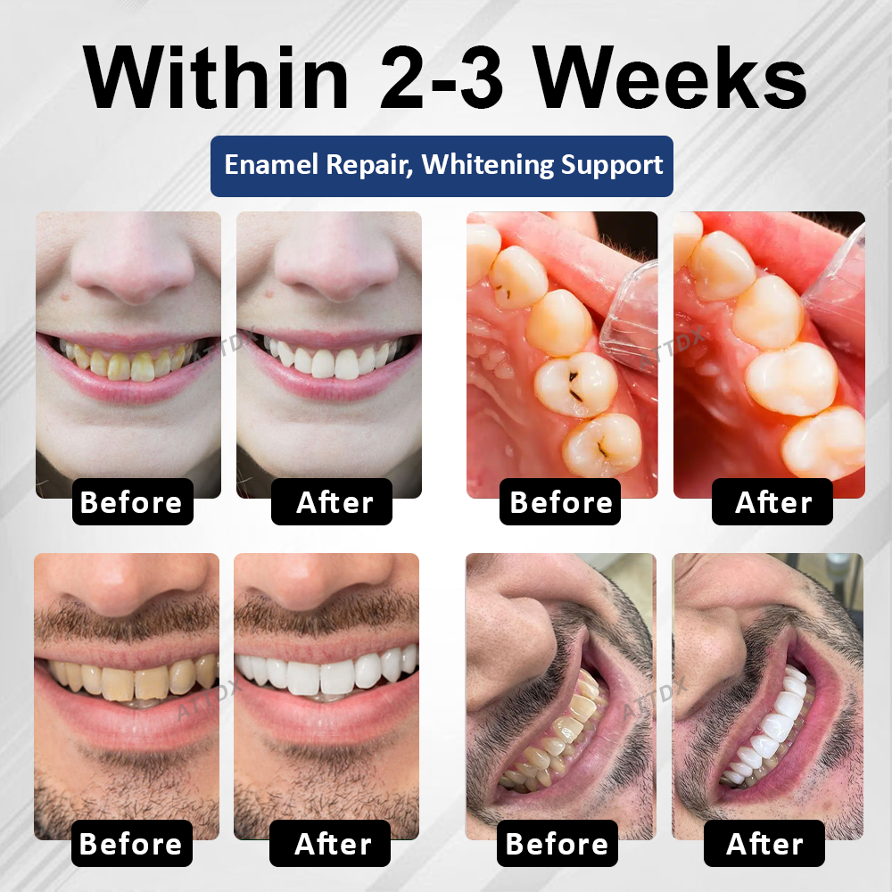 ATTDX® BioEnamel Biomimetic Tooth Armor Drops