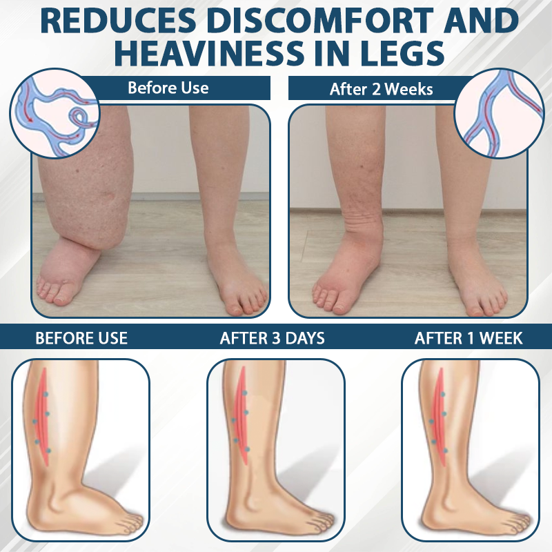 ATTDX® Black Cumin Edema Soothing Herbal Cream 33 ATTDX® Black Cumin Edema Soothing Herbal Cream