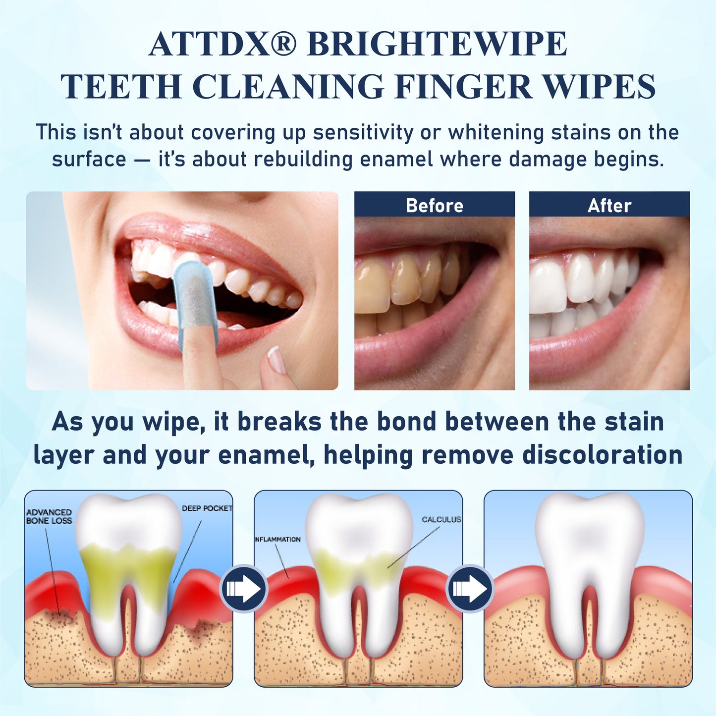 ATTDX® BrighteWipe Teeth Cleaning Finger Wipes