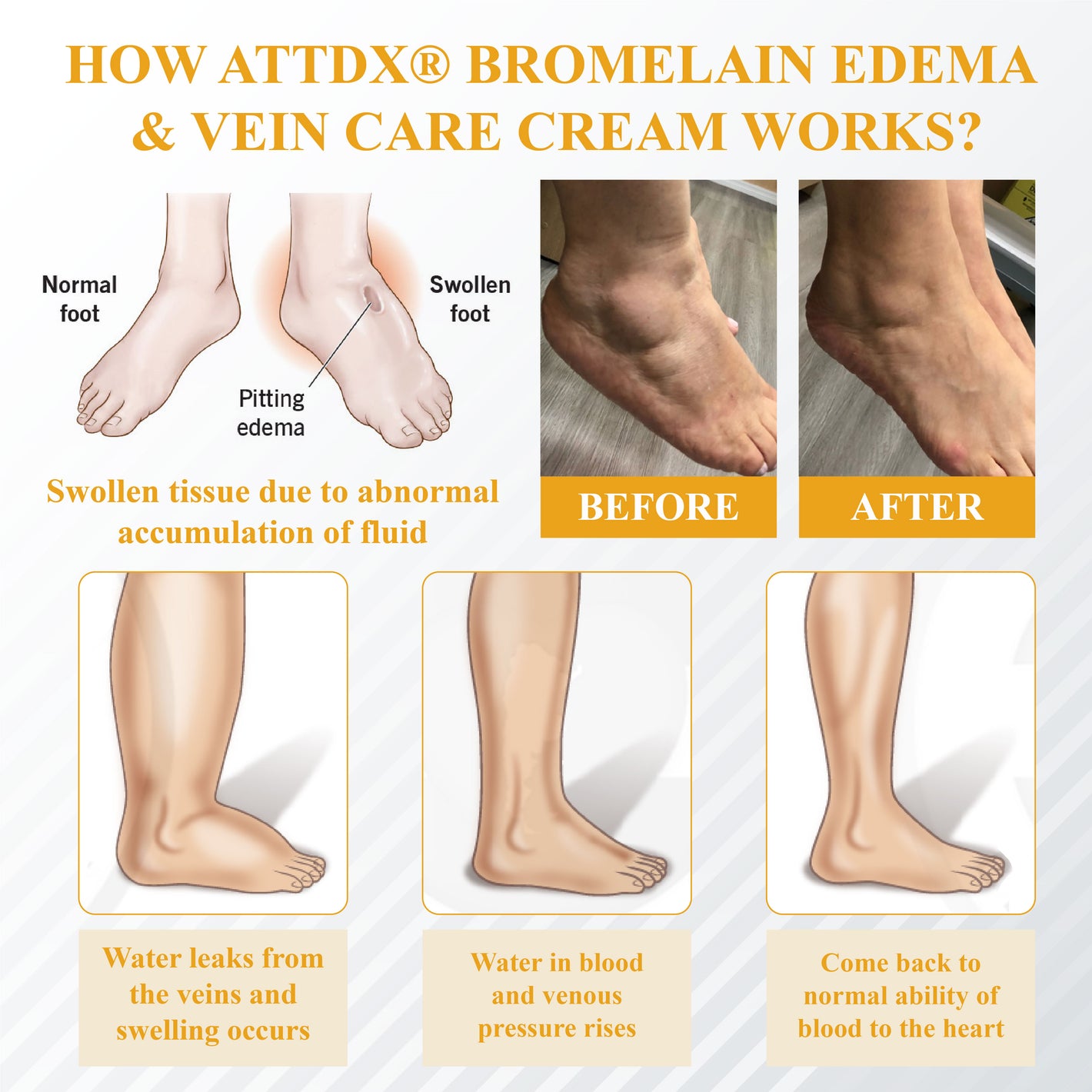 ATTDX® Bromelain Edema & Vein Care Cream 36 ATTDX® Bromelain Edema & Vein Care Cream