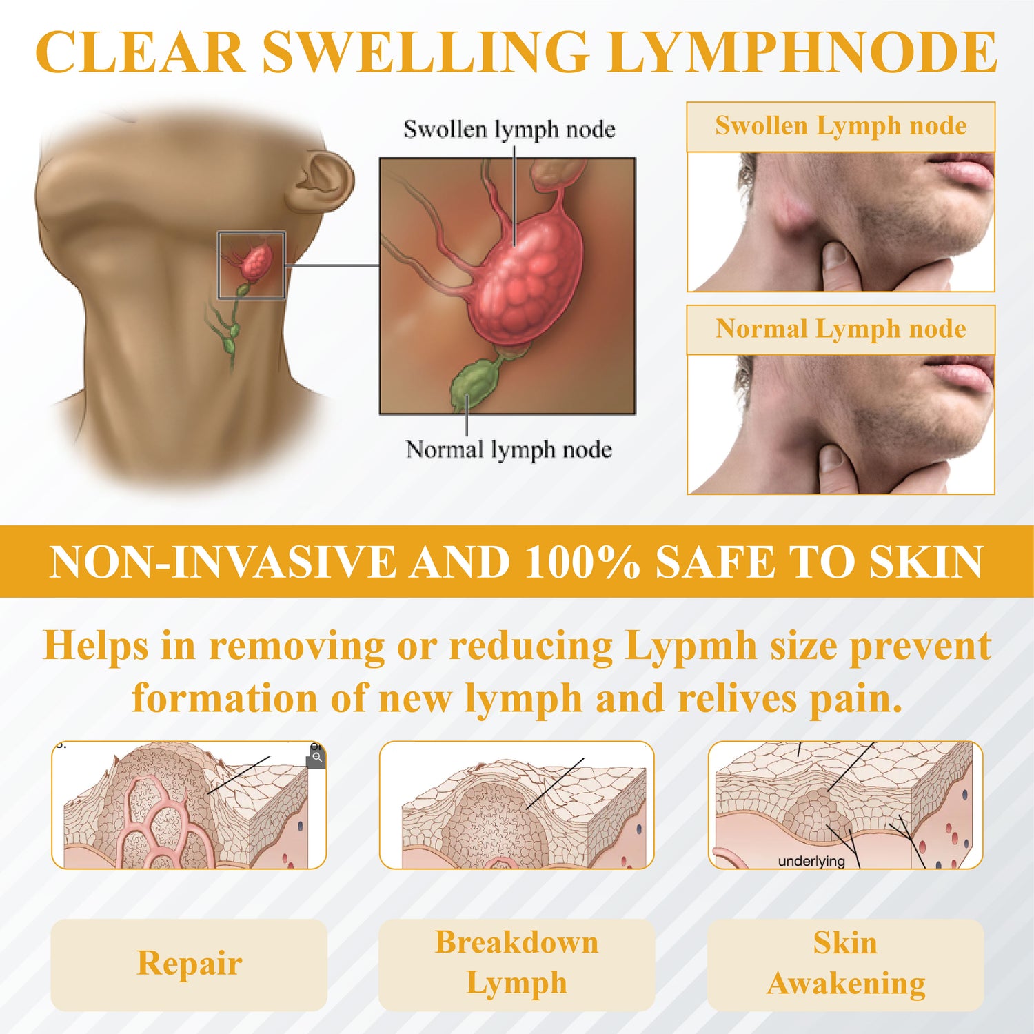 ATTDX® Bromelain Edema & Vein Care Cream 38 ATTDX® Bromelain Edema & Vein Care Cream