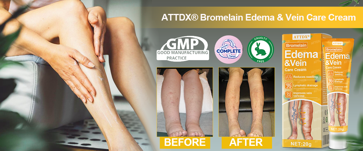 ATTDX® Bromelain Edema & Vein Care Cream 30 ATTDX® Bromelain Edema & Vein Care Cream