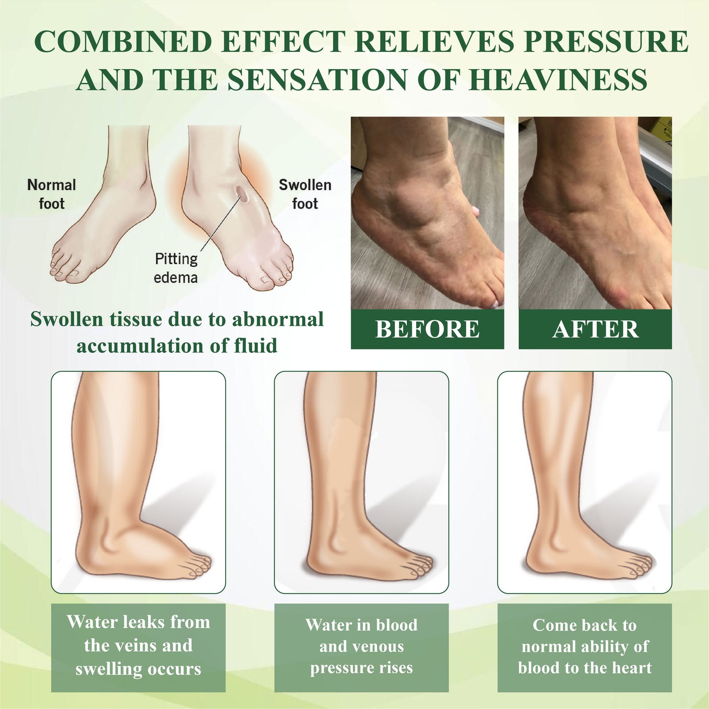 ATTDX® CircuFlex Leg Therapy Edema Spray