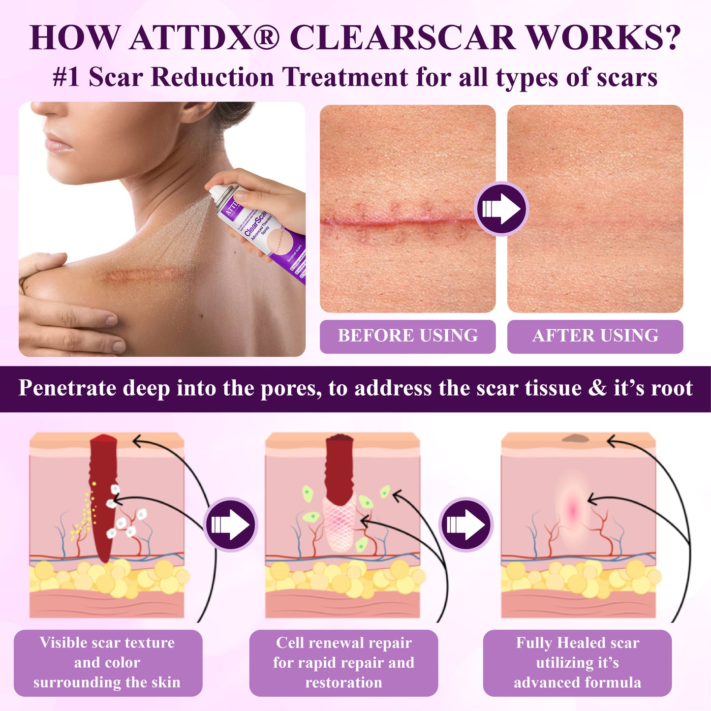 ATTDX® ClearScar Advanced Therapy Spray