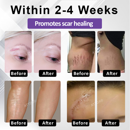 ATTDX® ClearScar Advanced Therapy Spray