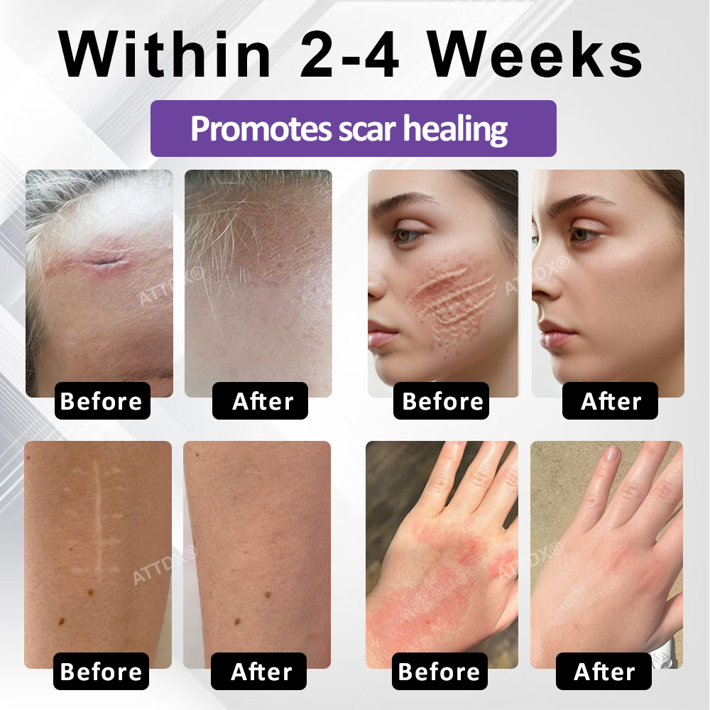 ATTDX® ClearScar Advanced Therapy Spray