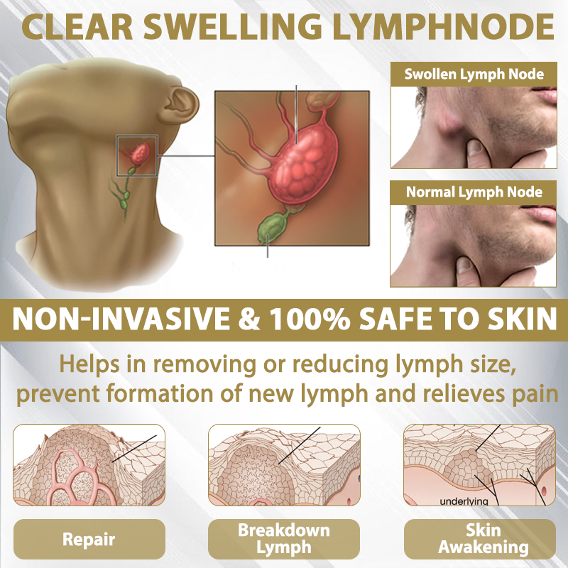 ATTDX® CortiEase Hormonal Swelling Balance Cream 32 ATTDX® CortiEase Hormonal Swelling Balance Cream