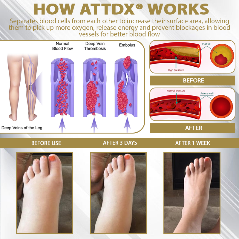 ATTDX® CortiEase Hormonal Swelling Balance Cream