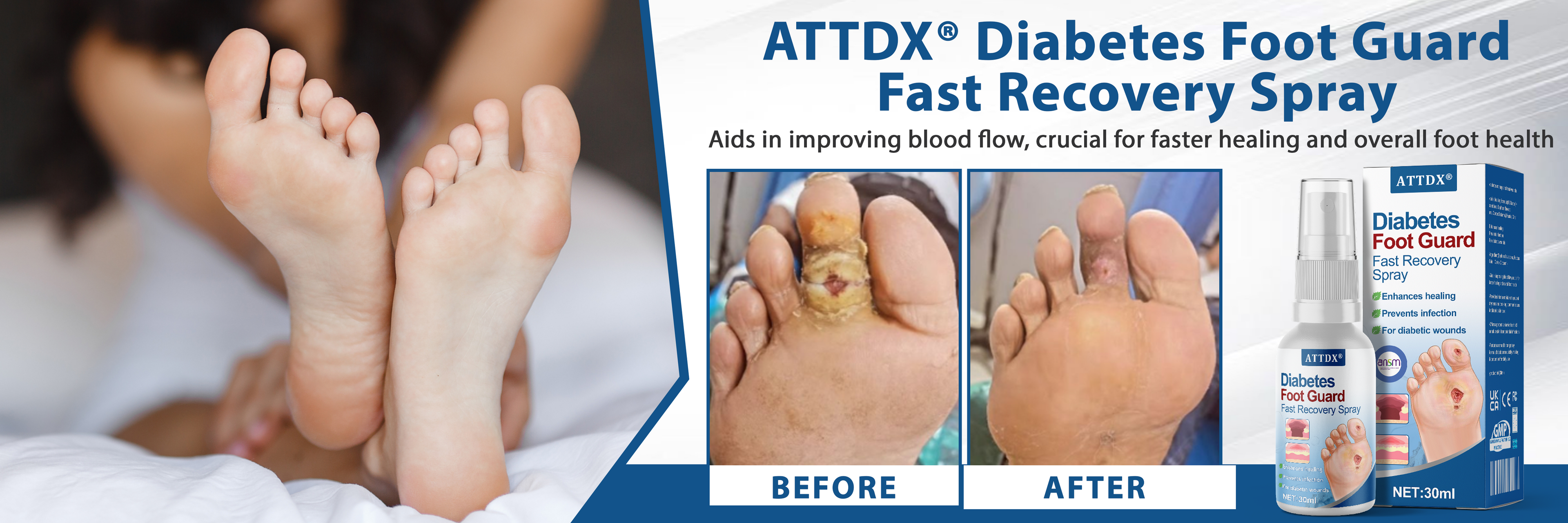 ATTDX® Diabetes Foot Guard Fast Recovery Spray 26 ATTDX® Diabetes Foot Guard Fast Recovery Spray
