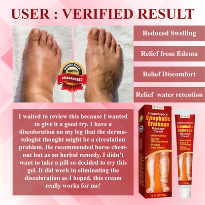 ATTDX® EdemaSupport Lymphatic Drainage Massage Cream 2