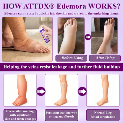 ATTDX® Edemora Overnight Balance Spray