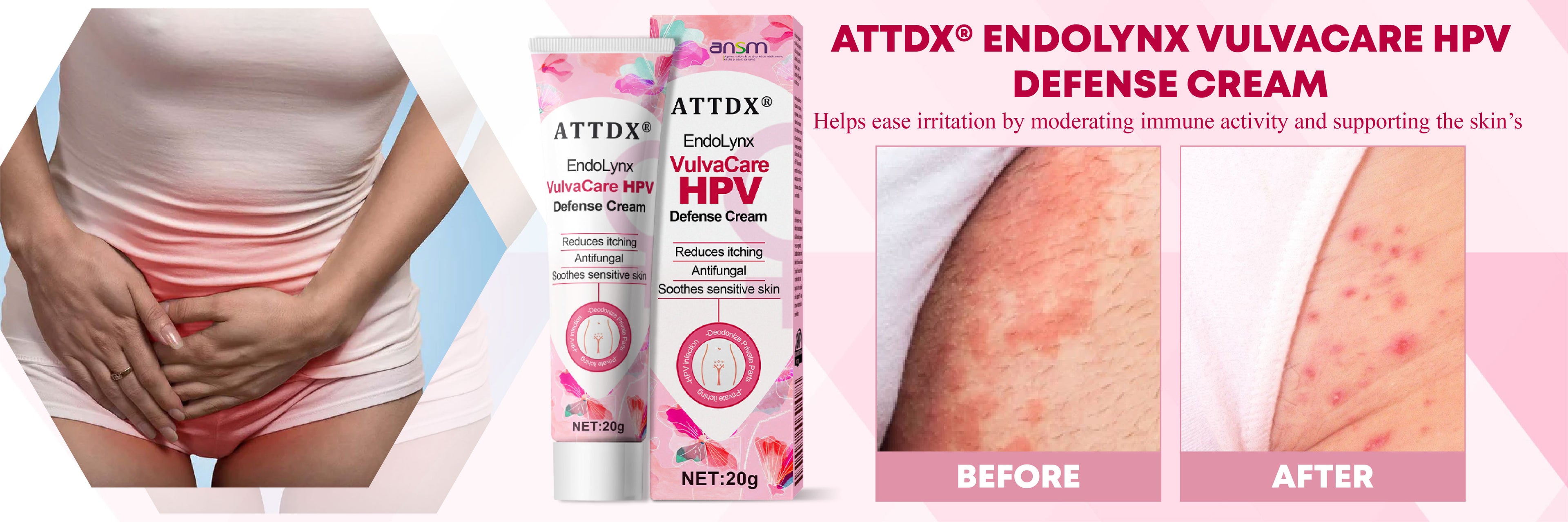 ATTDX® EndoLynx VulvaCare HPV Defense Cream 28 ATTDX® EndoLynx VulvaCare HPV Defense Cream